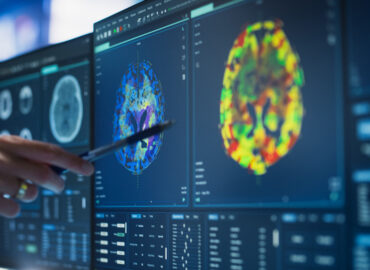 Ce face diferența în neurofeedback: aparatură clinică sau cască asiatică „de ultimă generație"?