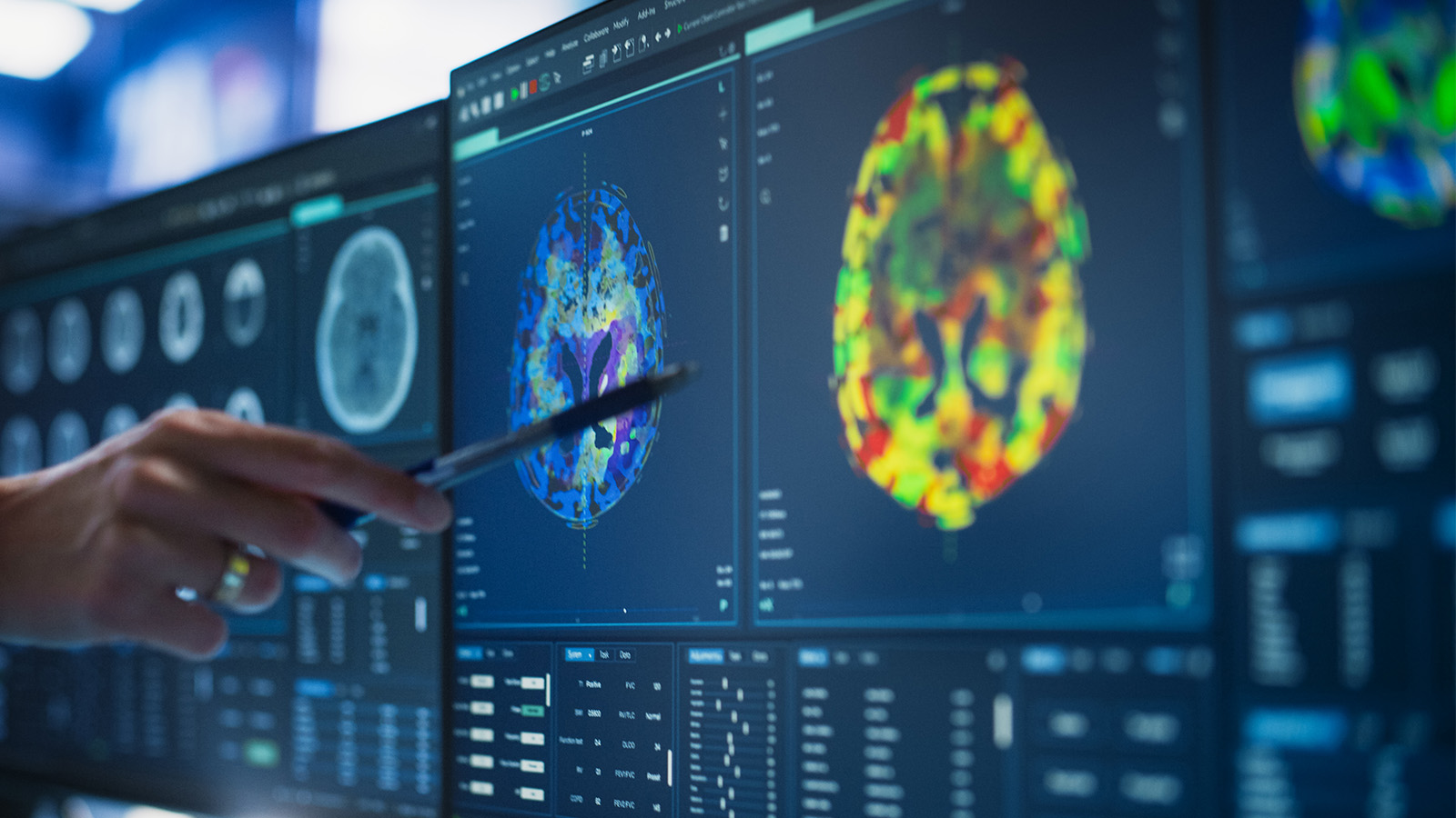 Ce face diferența în neurofeedback: aparatură clinică sau cască asiatică „de ultimă generație”?
